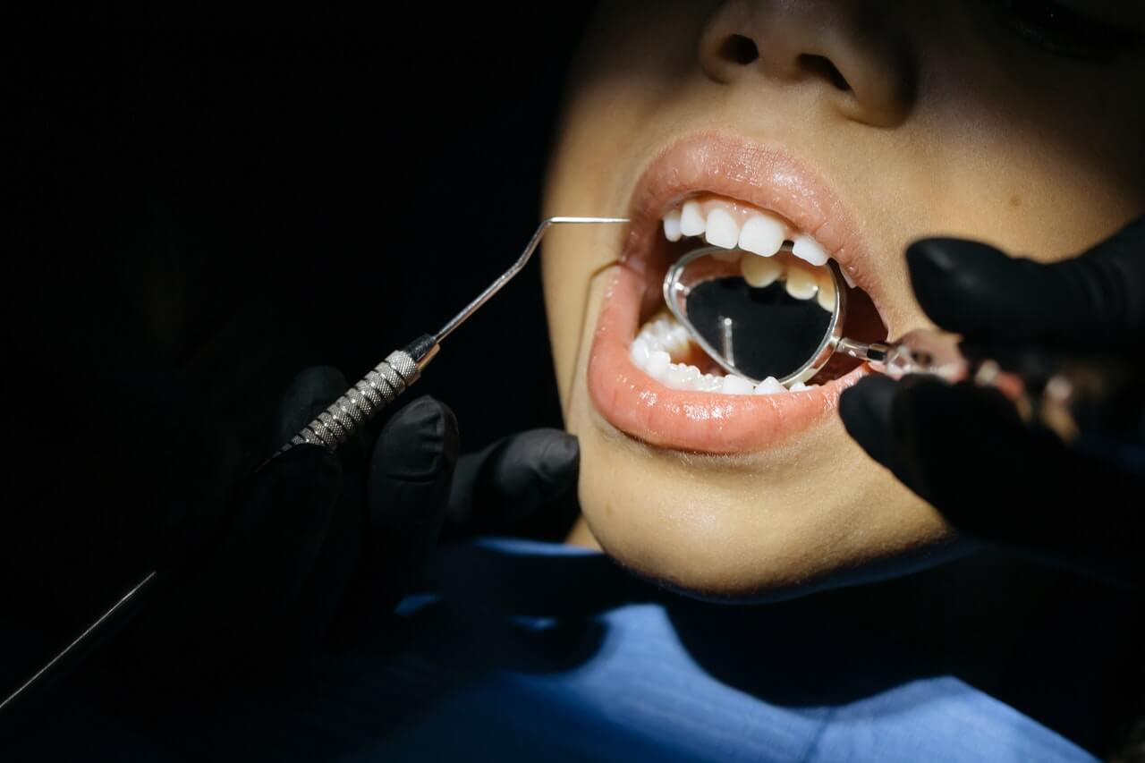 Candida w jamie ustnej - objawy, przyczyny i leczenie